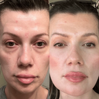 EyeRevive™ - Elimina Ojeras + Serúm de regalo
