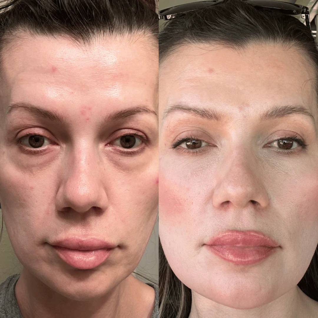 EyeRevive™ - Elimina Ojeras + Serúm de regalo