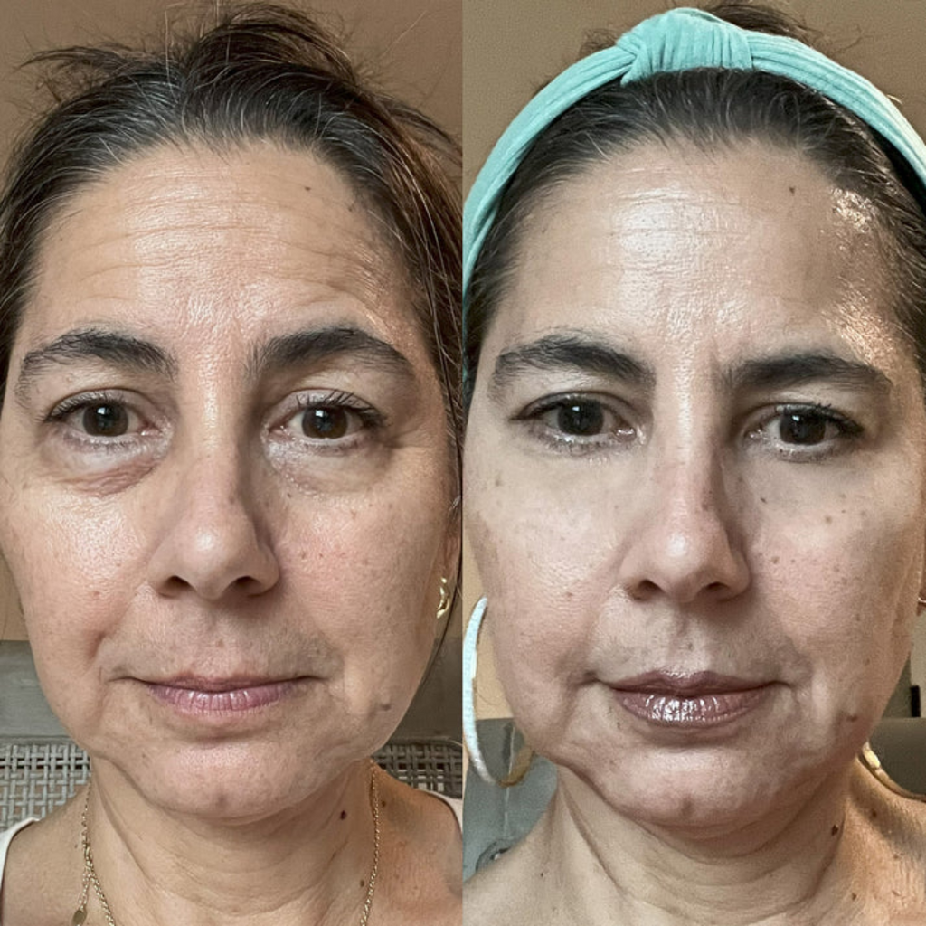 EyeRevive™ - Elimina Ojeras + Serúm de regalo