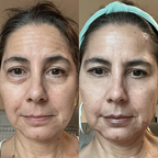 EyeRevive™ - Elimina Ojeras + Serúm de regalo