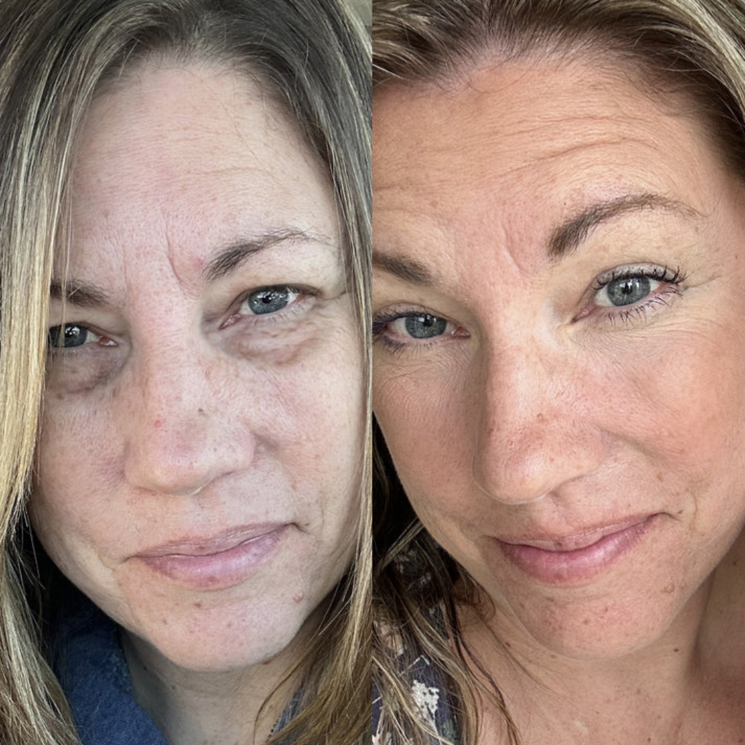 EyeRevive™ - Elimina Ojeras + Serúm de regalo