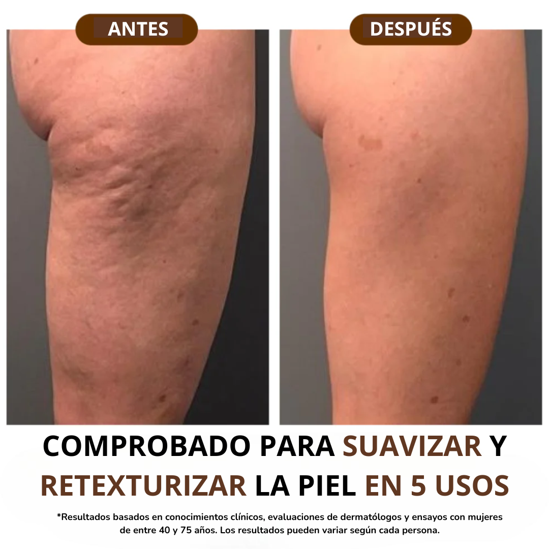 OceAura Elixir Corporal Antirrugas con Vitaminas A + E + F - 30 ml