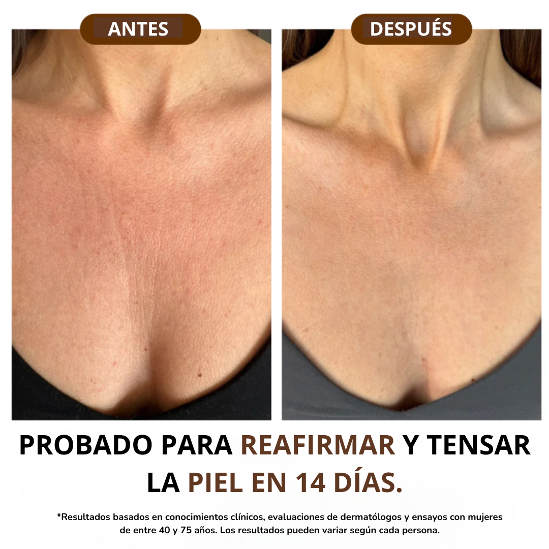 OceAura Elixir Corporal Antirrugas con Vitaminas A + E + F - 30 ml